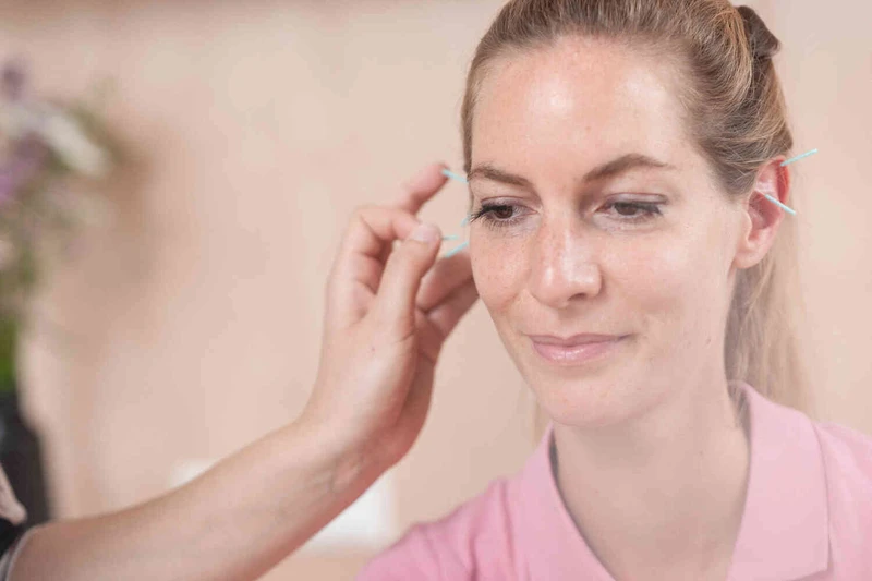 Nah aufnahme von Frau mit akupunktur im gesicht